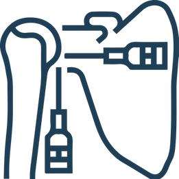 Cirugia de hombro y codo