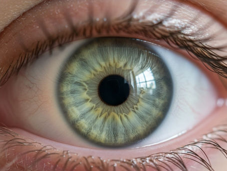 Cirurgia Para Mudar a Cor dos Olhos - Indicações Para Condições Oculares, Procedimento Técnico e Riscos Aos Pacientes