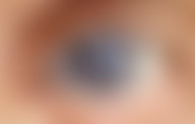 Cirurgia de Catarata em Idosos – Benefícios e Importância do Procedimento