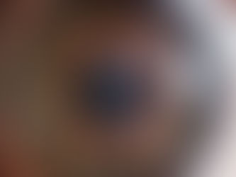 Descolamento de Retina: Sintomas, Diagnóstico e Procedimentos Mais Eficazes Para Saúde Ocular do Paciente