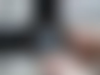 Tudo o Que Você Precisa Saber Sobre Implante de Prótese de Íris