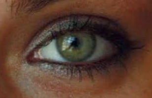 Condições Oculares Relacionadas a Problemas de Saúde na Íris dos Olhos