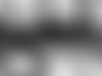 MUSCLE CLASSIFICATIONS & MUSCLE IMBALANCE PART 1