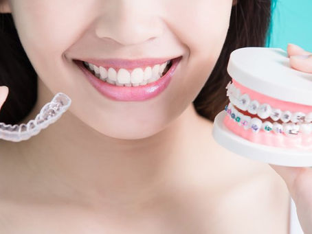 Can adults get braces?