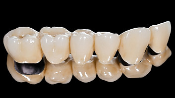 dental-crowns-and-bridges.jpg