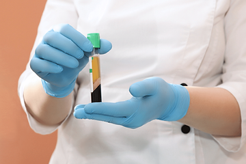 Stem-Cell-Therapy-Platelet-Rich-Plasma-10.png