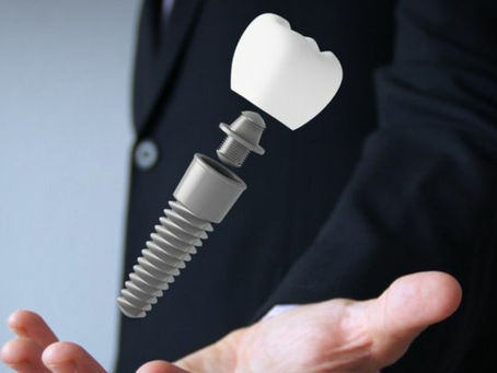 The Future is now: Dental Implants