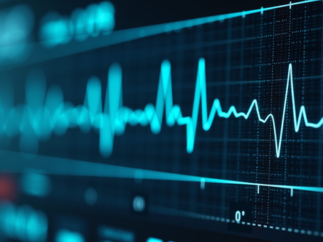 Unlocking the Power of EKG Analysis Services for Better Heart Health