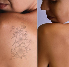 detatouage_pièce_tatto_2.jpg