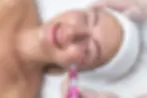 Microneedling-Kosmetik-Mainz.webp
