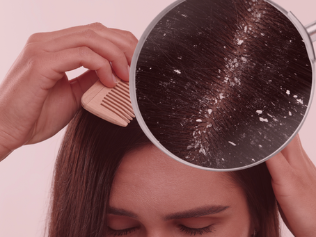 diferencia entre psoriasis del cuero cabelludo y caspa
