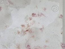 Phuket Issues Urgent Warning Over Venomous Jellyfish Surge