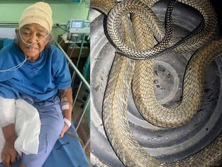 Woman Hospitalised After Cobra Bite as Snake Encounters Rise in Phuket