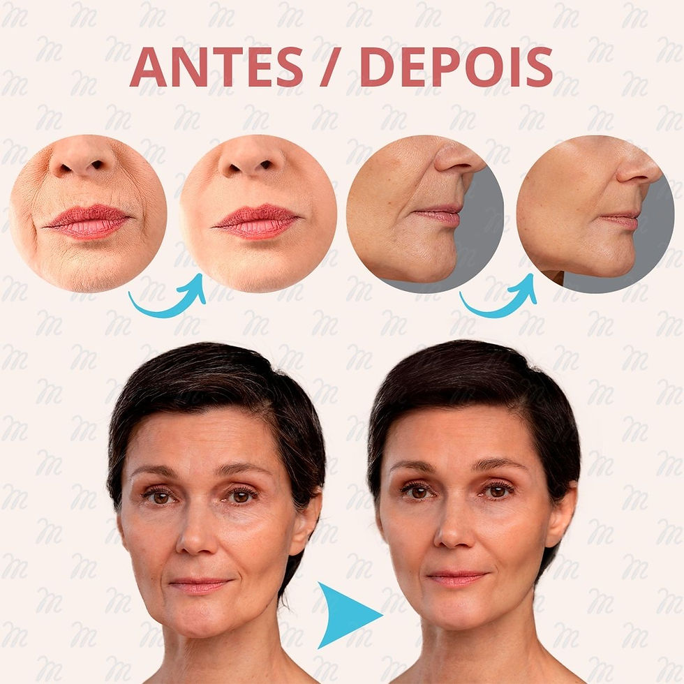 Miniatura: Adesivo Anti Rugas para Pescoço