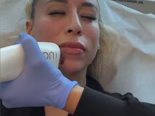 Why Everyone is Talking About the Moxi Laser