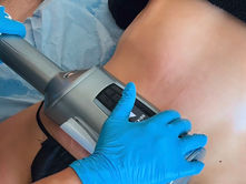 Why Post-Lipo Care Matters: The Secret to Getting the Best Results from Your Liposuction