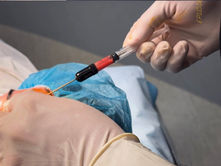 Facial Fat Transfer: A Natural Way to Restore Volume and Rejuvenate Your Appearance