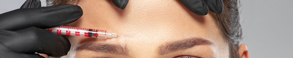 Preventative Botox