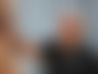 Understanding Implant Placement in Breast Augmentation: Over the Muscle vs. Under the Muscle