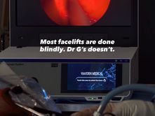 How Microscopic Visualization Is Elevating Modern Facelifts