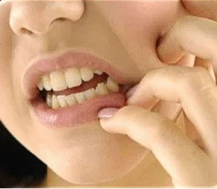 Chocolates and Oral Health