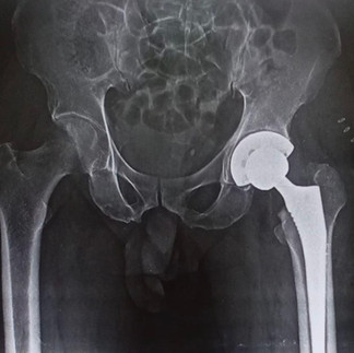 Dr Vinayaraj, Kossin Care