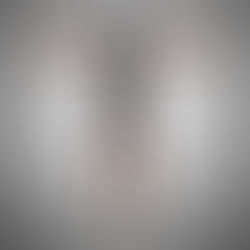 Understanding Joint Pain