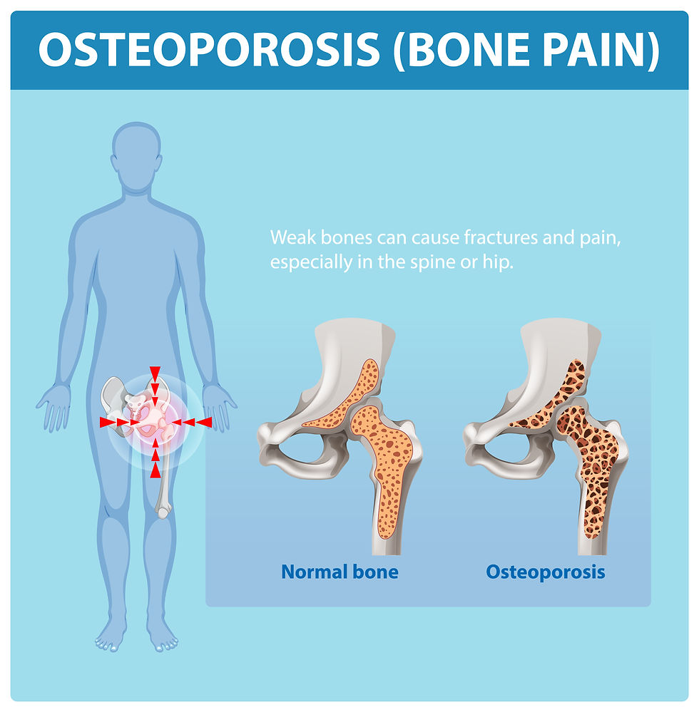 Osteoporosis