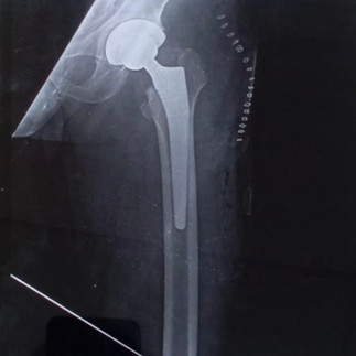 Dr Vinayaraj, Kossin Care