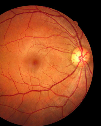 Human%252520eye%252520anatomy%252520taki