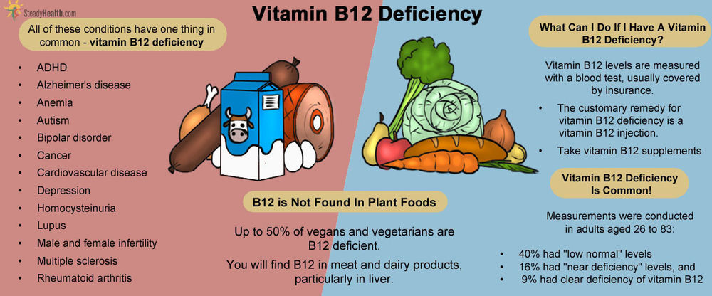 B12-deficiency anemia: causes, symptoms and treatment
