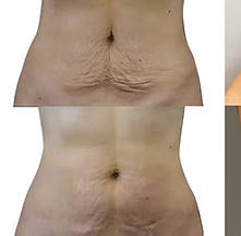 Body treatments are also available