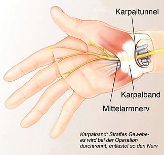 Der Karpaltunnel