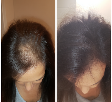 jessica antes e depois