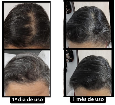 Cópia de RESULT 1 (Apresentação) (4).png