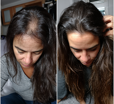 paula antes e depois
