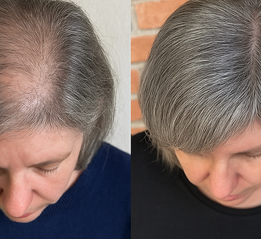 dn vera antes e depois