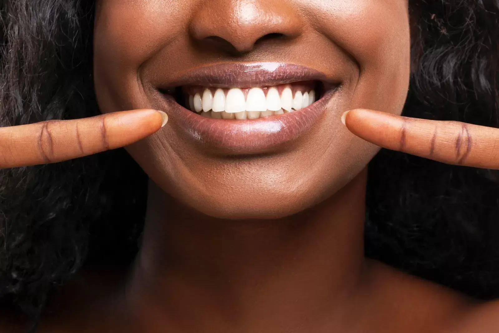 teeth whitening 