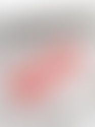 Your Insurance Covers the Surgery, Not the Stress: What No One Tells Patients