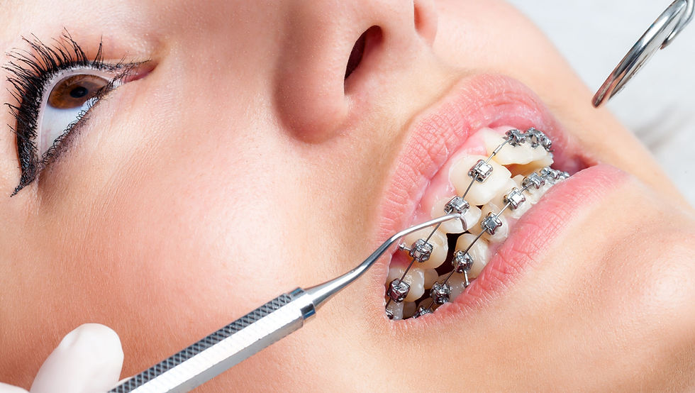 braces as an adult