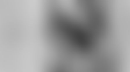 Заживление ран.