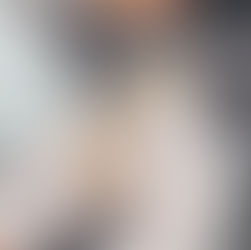 Nahaufnahme Zahnkronen-Modell wird bei Zahnärzte Dr. Mätzler mit Sonde kontrolliert