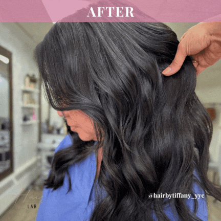 Best hair loss treatment in Calgary