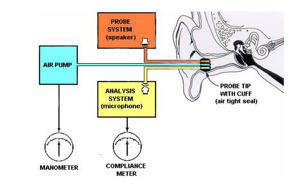 Tympanometry and its Role in (especially in children)