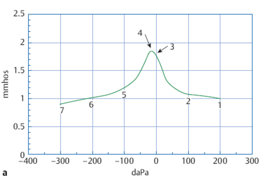 Tympanometry and its Role in (especially in children)