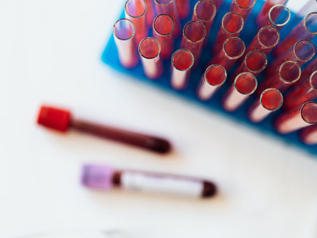 Familiarízate con tu análisis de sangre