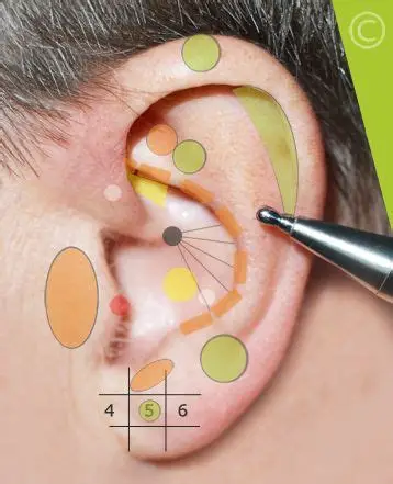 La réflexologie auriculaire permet de travailler sur les zones rcorrespondantes à certaines parties du corps