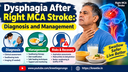 Dysphagia After Right MCA Stroke: Diagnosis and Management