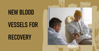 Angiogenesis After Stroke: Can New Blood Vessels Aid Recovery?