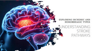 Inflammatory Pathways in Ischemic and Hemorrhagic Stroke